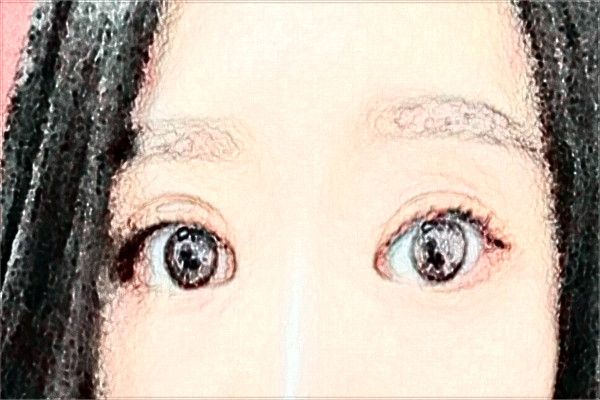 河北省人民醫(yī)院割雙眼皮做的怎么樣_哪位醫(yī)生技術(shù)比較好