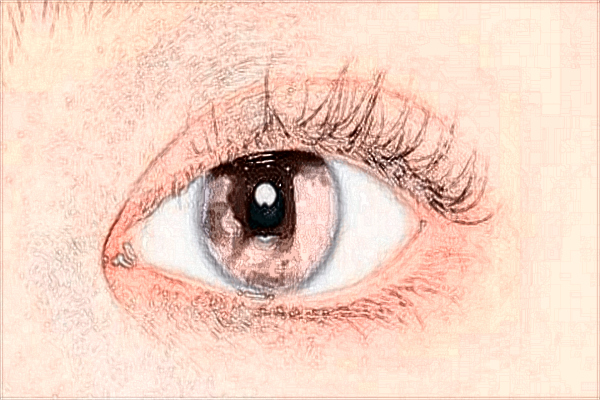 2024南寧303醫(yī)院近視激光手術(shù)多少錢(qián)?近視激光手術(shù)要求度數(shù)