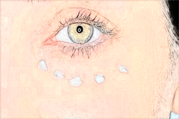 2024蘇州激光近視醫(yī)院排行榜?排行有你想要的