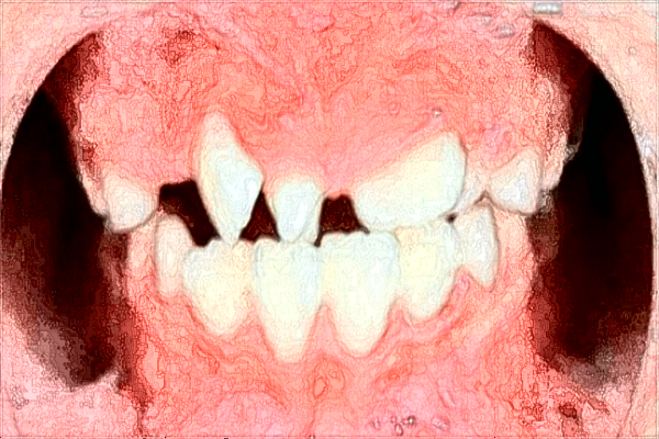 貴陽醫(yī)學院附屬醫(yī)院口腔科怎么樣?口腔科是不是牙科