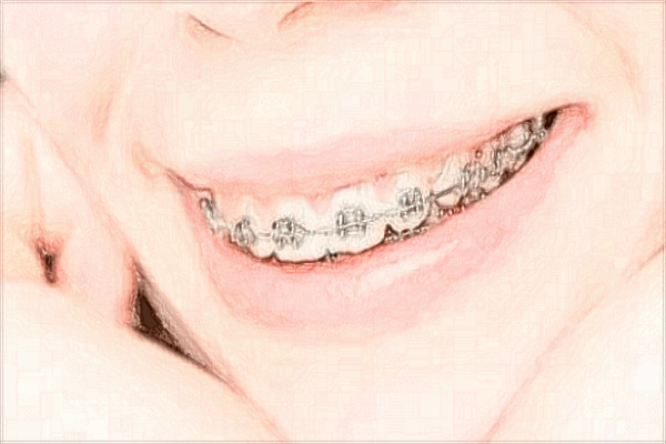 青島海慈醫(yī)院口腔科主任好不好?2024收費(fèi)價(jià)格