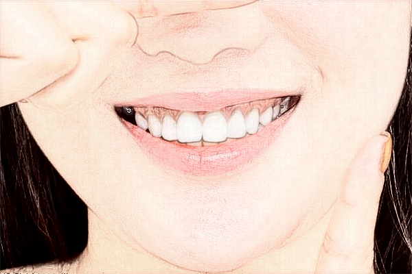 青島海慈醫(yī)院口腔科怎么樣?口腔科怎么檢查