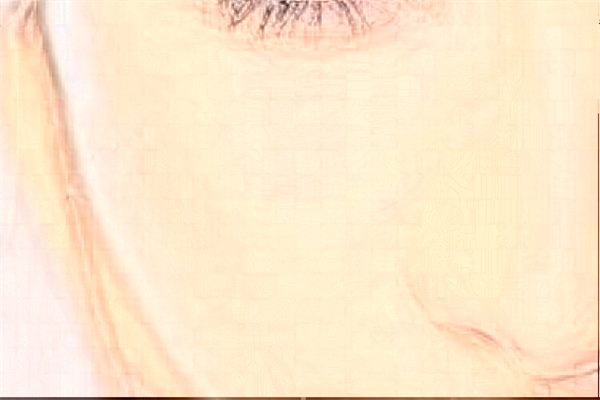 2024青島海慈醫(yī)院光子嫩膚報價?光子嫩膚有副作用和危險嗎