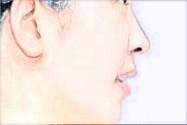 南京鼓樓醫(yī)院做的好嗎？誰做的好