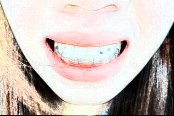 無錫市第一人民醫(yī)院口腔科種植牙做的怎么樣_誰做的比較好