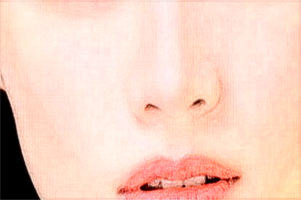 哈爾濱醫(yī)科大學(xué)附屬第一醫(yī)院隆鼻做的好嗎_隆鼻整形日記分享