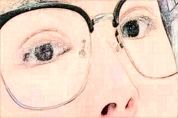 2024天津市醫(yī)科大學(xué)眼科醫(yī)院半飛秒價(jià)格多少?做的怎么樣