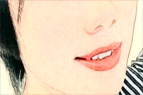 杭州市第一人民醫(yī)院激光脫毛做的好嗎?案例反饋