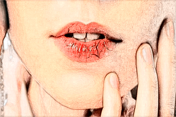 2024中山大學(xué)附屬第三醫(yī)院隱形牙套多少錢(qián)?隱形牙套貴嗎