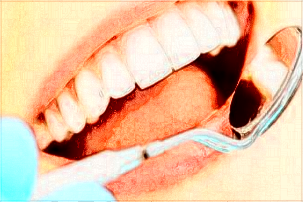 2024中山大學(xué)附屬第三醫(yī)院正畸費用?正畸和矯正的區(qū)別