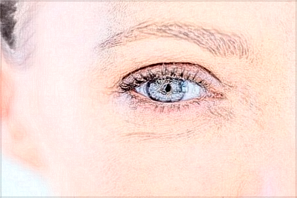 2024佛山市第二人民醫(yī)院全飛秒手術(shù)價錢?全飛秒手術(shù)恢復(fù)期多久