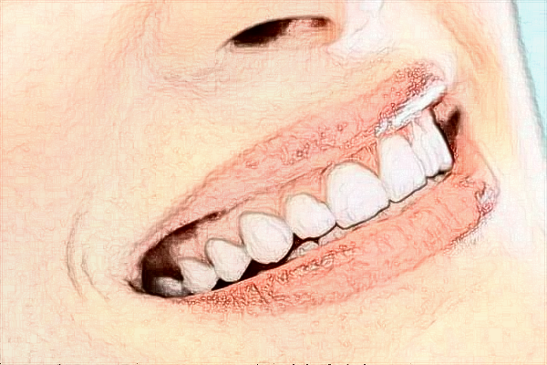 2024山東省千佛山醫(yī)院口腔科專家有哪些?專家收費貴嗎?