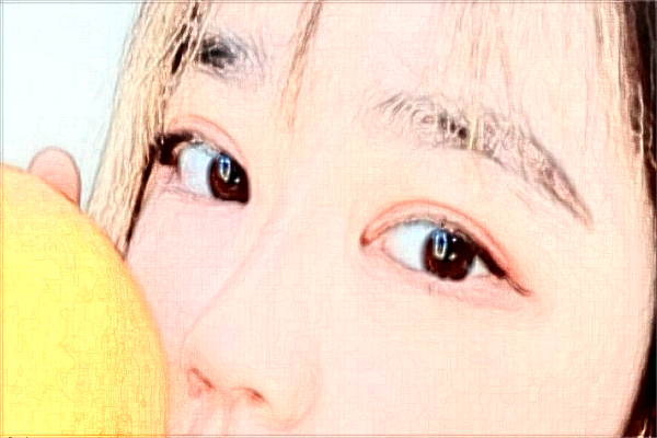 2024太原市中心醫(yī)院近視激光手術(shù)怎么樣?實(shí)測(cè)案例分享