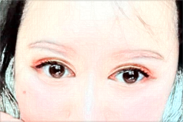 2024太原市中心醫(yī)院近視激光手術(shù)怎么樣?實(shí)測(cè)案例分享