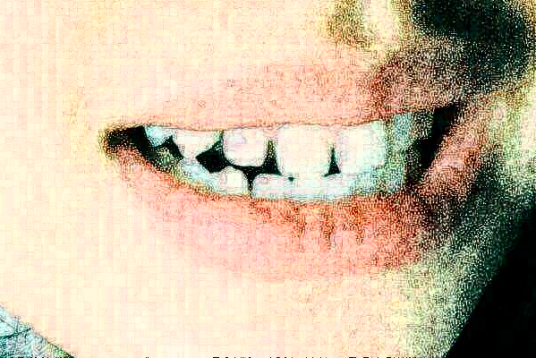 無錫市第一人民醫(yī)院口腔科全瓷牙做的怎么樣_哪位醫(yī)生做得好