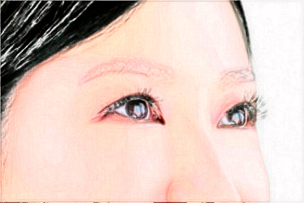 天津市醫(yī)科大學眼科醫(yī)院近視怎么樣_整形日記分享