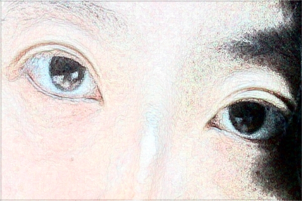 天津市醫(yī)科大學眼科醫(yī)院近視怎么樣_整形日記分享