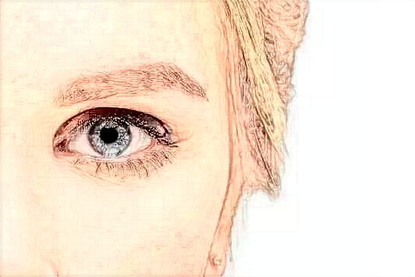 2024青島市立醫(yī)院熱瑪吉多少錢(qián)?熱瑪吉有什么后遺癥?