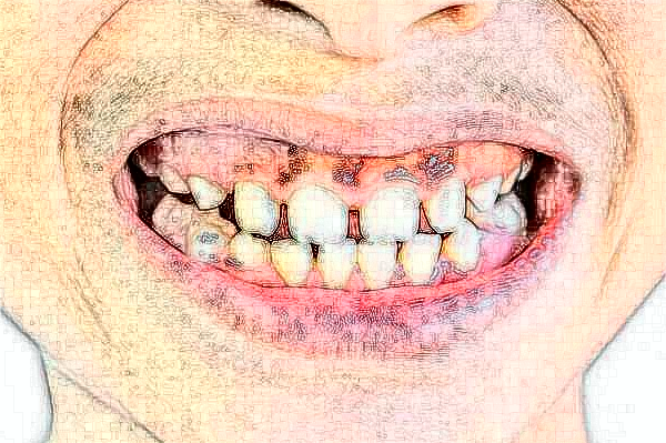 2024山西醫(yī)科大學(xué)第一醫(yī)院口腔科唇腭裂修復(fù)誰(shuí)做得好