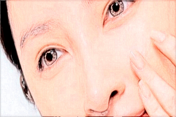 2024天津醫(yī)科大學總醫(yī)院可以去胎記嗎？去胎記真實案例