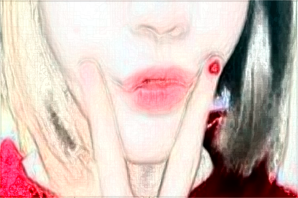 保定市第一中心醫(yī)院去疤痕做的好嗎?案例反饋