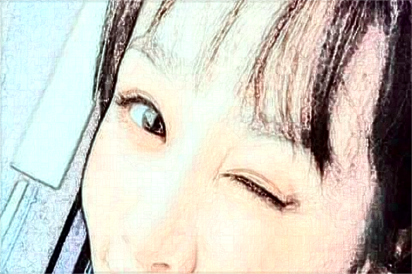 天津醫(yī)科大學(xué)總醫(yī)院光子嫩膚價格多少?光子嫩膚案例分享