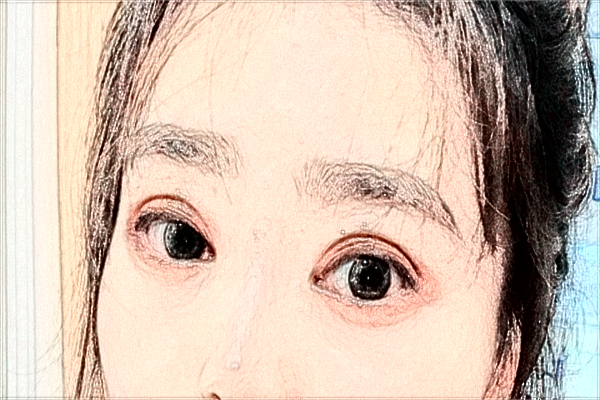 延邊醫(yī)院光子嫩膚醫(yī)生排名_口碑+價格