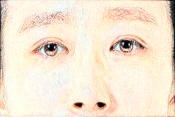 大連新華醫(yī)院近視手術(shù)誰做的好?醫(yī)生推薦