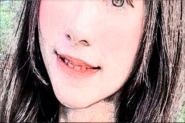 大連醫(yī)科大學(xué)附屬第一醫(yī)院自體脂肪填充怎么樣_哪位醫(yī)生做得好