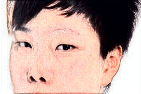 天津市醫(yī)科大學(xué)眼科醫(yī)院專(zhuān)家有哪些_醫(yī)生介紹