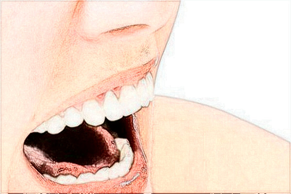 2024中山大學附屬口腔醫(yī)院根管收費標準?根管要多久