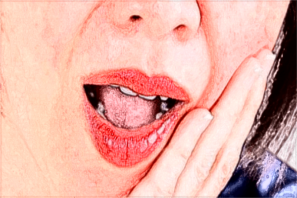 中山大學附屬口腔醫(yī)院拔牙貴嗎?拔牙的危害有多大