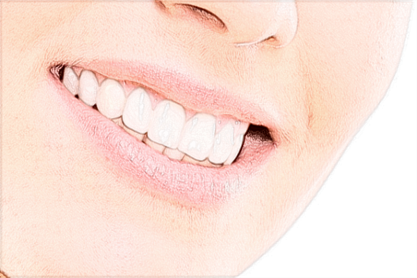 2024武漢大學口腔醫(yī)院烤瓷牙多少錢—顆?烤瓷牙好嗎?