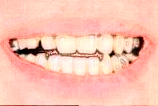 大連大學(xué)附屬中山醫(yī)院口腔科錯牙合畸形矯正做的好嗎?醫(yī)生推薦