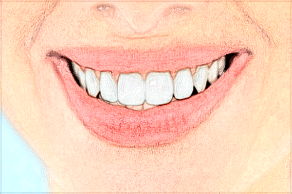 青島海慈醫(yī)院牙科誰好?2024牙科收費價格多少