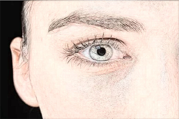 2024臨沂市人民醫(yī)院做飛秒手術(shù)價(jià)格?哪個(gè)醫(yī)生做飛秒好?