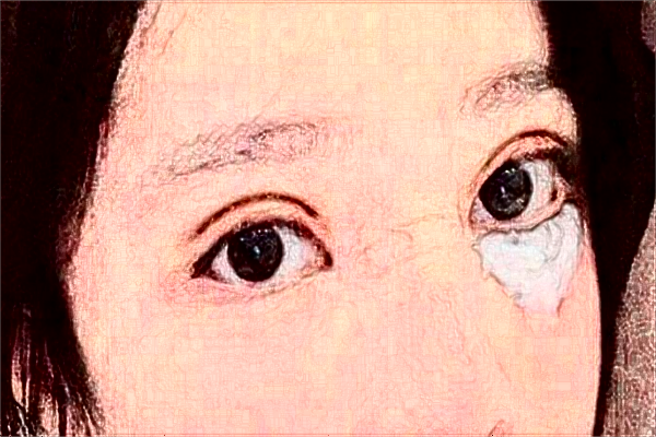 揚(yáng)州市第一人民醫(yī)院半飛秒價(jià)格是多少?那個(gè)醫(yī)生好