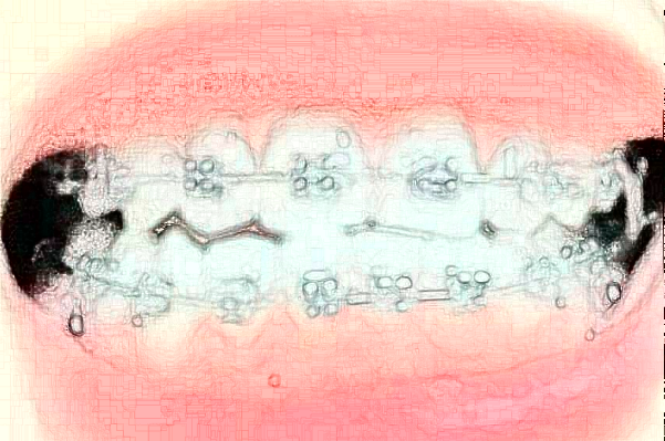 大慶市人民醫(yī)院口腔科牙齒矯正技術(shù)好嗎?醫(yī)生介紹