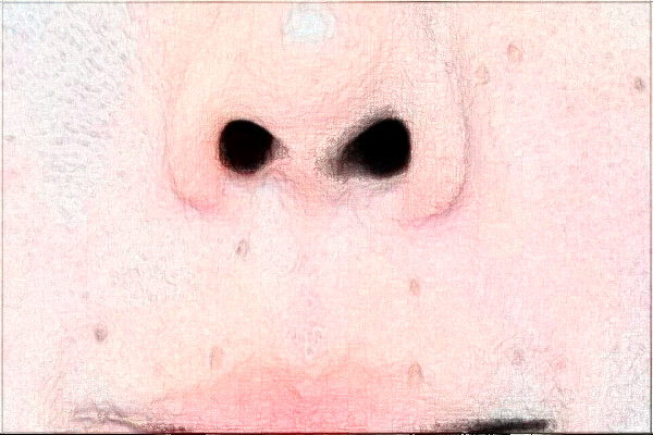 無(wú)錫市第一人民醫(yī)院激光脫毛做的怎么樣_誰(shuí)做的比較好 