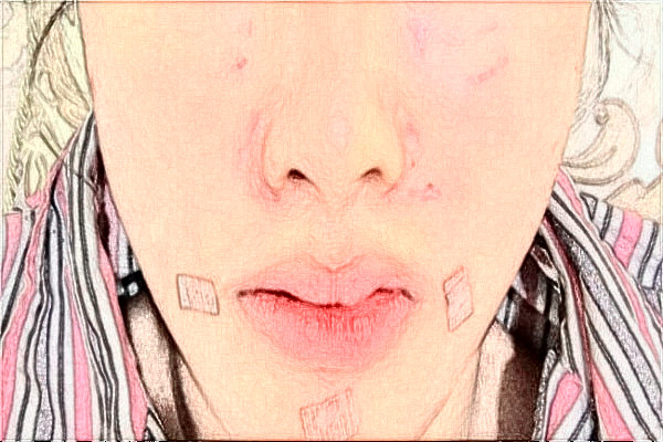 無(wú)錫市第一人民醫(yī)院激光脫毛做的怎么樣_誰(shuí)做的比較好 