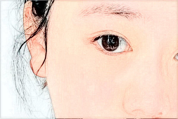 2024揚(yáng)州市第一人民醫(yī)院去眼袋價(jià)格是多少?那個(gè)醫(yī)生好