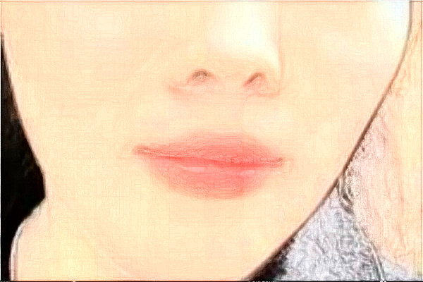 2024大慶市人民醫(yī)院面部提升怎么樣?全新案例分享