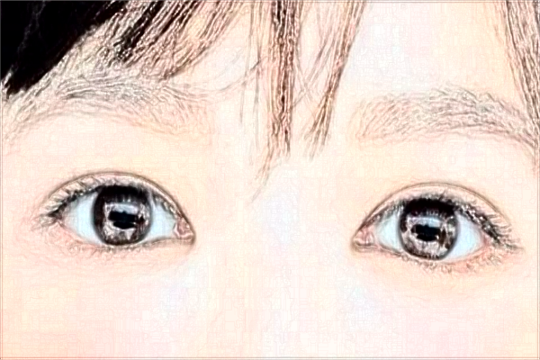 2024吉林大學(xué)第一醫(yī)院全飛秒做的好嗎?誰(shuí)做得好