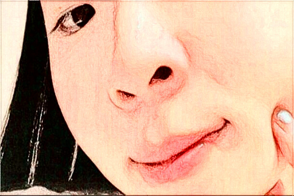 2024沈陽盛京醫(yī)院祛疤痕做的怎么樣【祛疤痕案例分享】