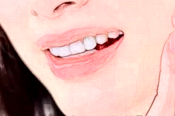 2024大連新華醫(yī)院口腔科牙列畸形矯正怎么樣_醫(yī)生名單推薦