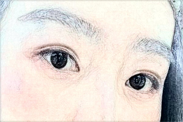 2024南京中大醫(yī)院割眼皮怎么樣_醫(yī)生名單推薦