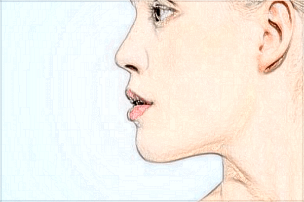 2024煙臺毓璜頂醫(yī)院光子嫩膚多少錢?光子嫩膚祛斑怎么樣