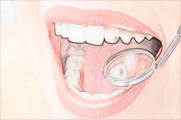 2024惠州市中心人民醫(yī)院拔一顆智齒多少錢(qián)?拔智齒貴嗎