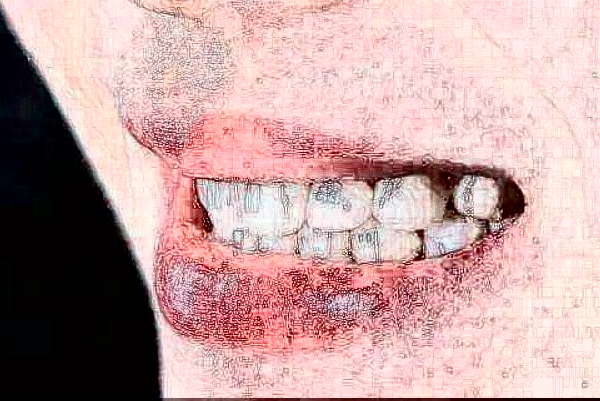 溫州醫(yī)學院附屬第二醫(yī)院口腔科烤瓷牙做的怎么樣_誰做的比較好