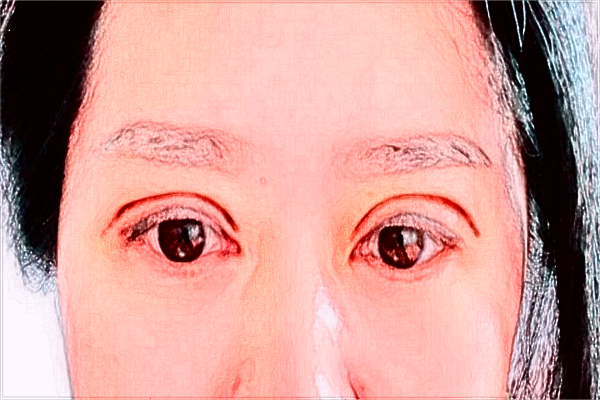 安徽省立醫(yī)院整形外科哪個(gè)醫(yī)生好_醫(yī)生排名介紹